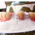 Revestimiento dental laboratório